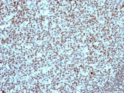 Nucleolin Monoclonal Mouse Antibody (NCL/902)