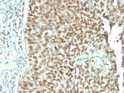 Nucleolin Monoclonal Mouse Antibody (NCL/902)