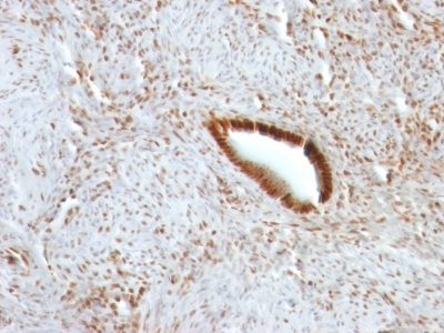 Nucleolin Monoclonal Mouse Antibody (NCL/902)