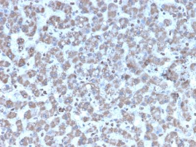 Prohibitin Monoclonal Mouse Antibody (PHB/3194)