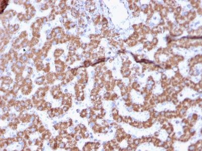 Prohibitin Monoclonal Mouse Antibody (PHB/3225)