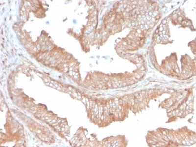 CD47 Monoclonal Mouse Antibody (CD47/3019)