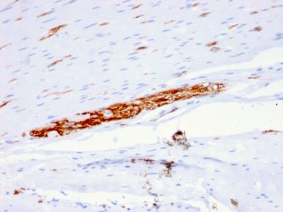 CD56 / NCAM Monoclonal Mouse Antibody (ERIC-1)