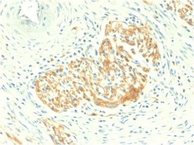 CD56 / NCAM Recombinant Monoclonal Rabbit Antibody (NCAM1/2217R)