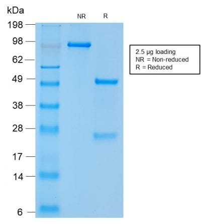 CD56 / NCAM Recombinant Monoclonal Rabbit Antibody (NCAM1/2217R)
