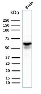 GAD1 / GAD67 Monoclonal Mouse Antibody (GAD1/2391)