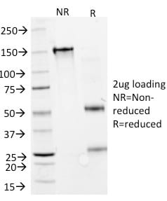 GAD1 / GAD67 Monoclonal Mouse Antibody (GAD1/2391)