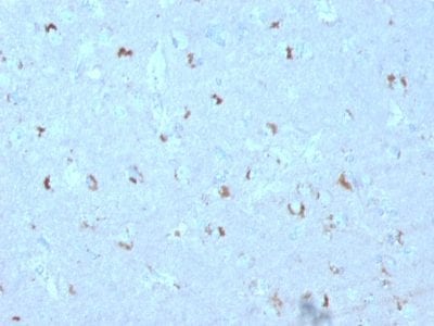 GAD1 / GAD67 Monoclonal Mouse Antibody (GAD1/2563)