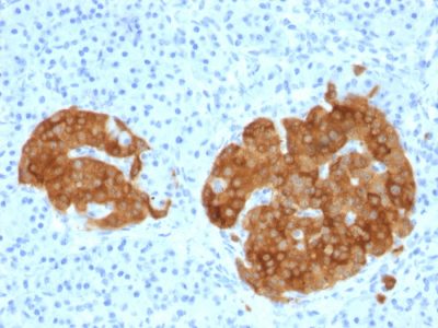 GAD2 / GAD65 Monoclonal Mouse Antibody (GAD2/1960)