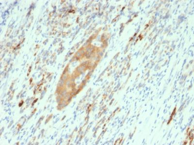 GAD2 / GAD65 Monoclonal Mouse Antibody (GAD2/2362)