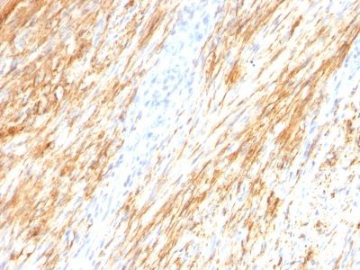 GFAP Monoclonal Mouse Antibody (ASTRO/789)