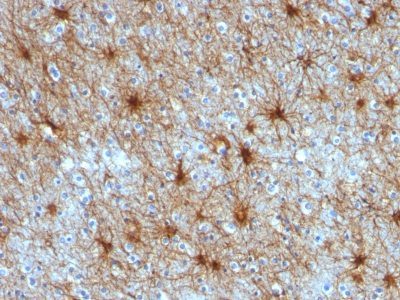 GFAP Monoclonal Mouse Antibody (ASTRO/789)