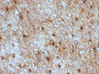 GFAP Monoclonal Mouse Antibody (GA-5 + ASTRO/789)