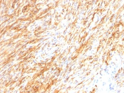 GFAP Monoclonal Mouse Antibody (GA-5 + ASTRO/789)