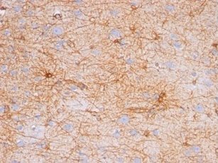 GFAP Monoclonal Mouse Antibody (GA-5)