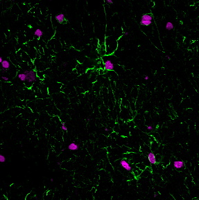 GFAP Monoclonal Mouse Antibody (GA-5)