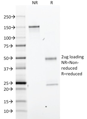 GFAP Monoclonal Mouse Antibody (GA-5)
