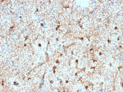 GFAP Monoclonal Mouse Antibody (GFAP/2076)