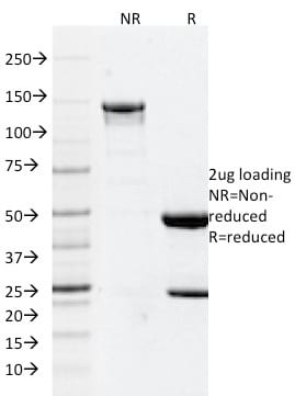 GFAP Monoclonal Mouse Antibody (GFAP/2076)