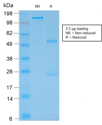 GFAP Recombinant Monoclonal Mouse Antibody (rASTRO/789)