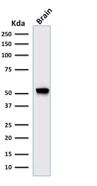 GFAP Recombinant Monoclonal Mouse Antibody (rASTRO/789)