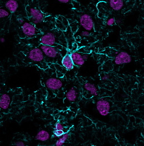 GFAP Recombinant Monoclonal Rabbit Antibody (ASTRO/1974R)