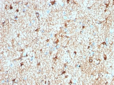 GFAP Recombinant Monoclonal Rabbit Antibody (ASTRO/1974R)