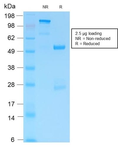GFAP Recombinant Monoclonal Rabbit Antibody (ASTRO/1974R)