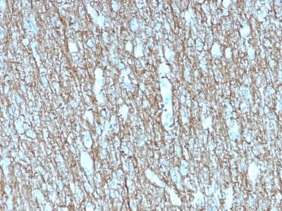 Neurofilament Recombinant Monoclonal Mouse Antibody (rNF421)
