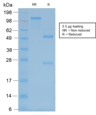 Neurofilament Recombinant Monoclonal Mouse Antibody (rNF421)
