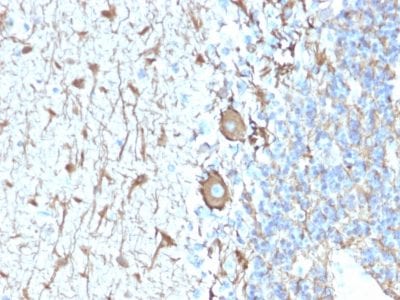 Neurofilament Recombinant Monoclonal Rabbit Antibody (NEFL.H/2324R)