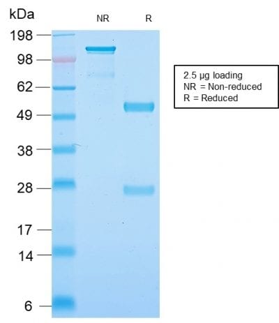 Neurofilament Recombinant Monoclonal Rabbit Antibody (NEFL.H/2324R)