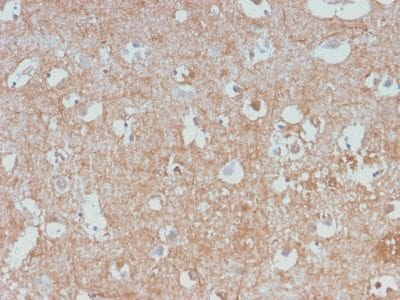 Neurofilament Recombinant Monoclonal Rabbit Antibody (NEFL/2983R)