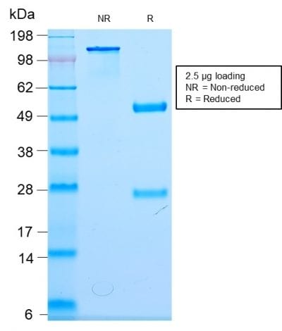 Neurofilament Recombinant Monoclonal Rabbit Antibody (NEFL/2983R)