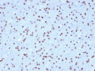 OLIG2 Monoclonal Mouse Antibody (OLIG2/2400)