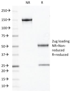 OLIG2 Monoclonal Mouse Antibody (OLIG2/2400)