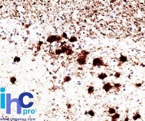 PGP9.5 / UchL1 Monoclonal Mouse Antibody (31A3)