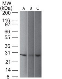 PGP9.5 / UchL1 Monoclonal Mouse Antibody (31A3)