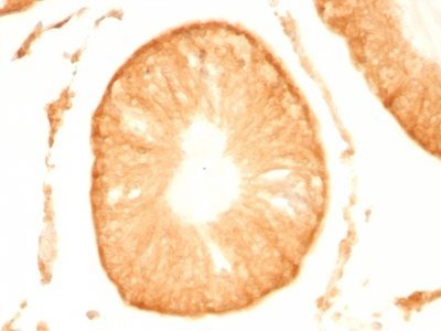 PGP9.5 / UchL1 Monoclonal Mouse Antibody (UCHL1/775)