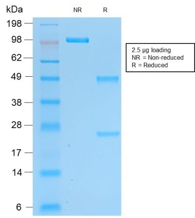 PGP9.5 / UchL1 Recombinant Monoclonal Mouse Antibody (rUCHL1/775)