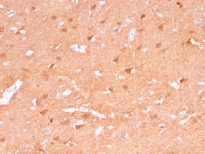 PGP9.5 / UchL1 Recombinant Monoclonal Mouse Antibody (rUCHL1/775)