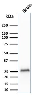 PGP9.5 / UchL1 Recombinant Monoclonal Mouse Antibody (rUCHL1/775)