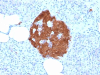 PGP9.5 / UchL1 Recombinant Monoclonal Mouse Antibody (rUCHL1/775)