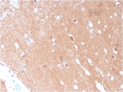 Tubulin beta 3 / TUBB3 Monoclonal Mouse Antibody (TUBB3/3731)