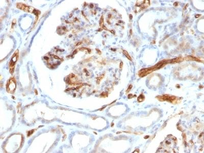 Adiponectin Monoclonal Mouse Antibody (ADPN/1370)