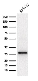 Adiponectin Monoclonal Mouse Antibody (ADPN/1370)