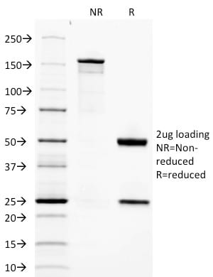 Adiponectin Monoclonal Mouse Antibody (ADPN/1370)