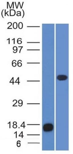 Adipophilin / Perilipin-2 Monoclonal Mouse Antibody (ADFP/1365)