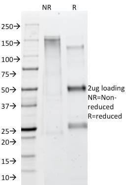 Adipophilin / Perilipin-2 Monoclonal Mouse Antibody (ADFP/1365)