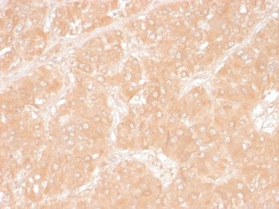 Adipophilin / Perilipin-2 Monoclonal Mouse Antibody (ADFP/1366)